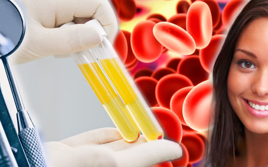 Platelet fibrin therapy